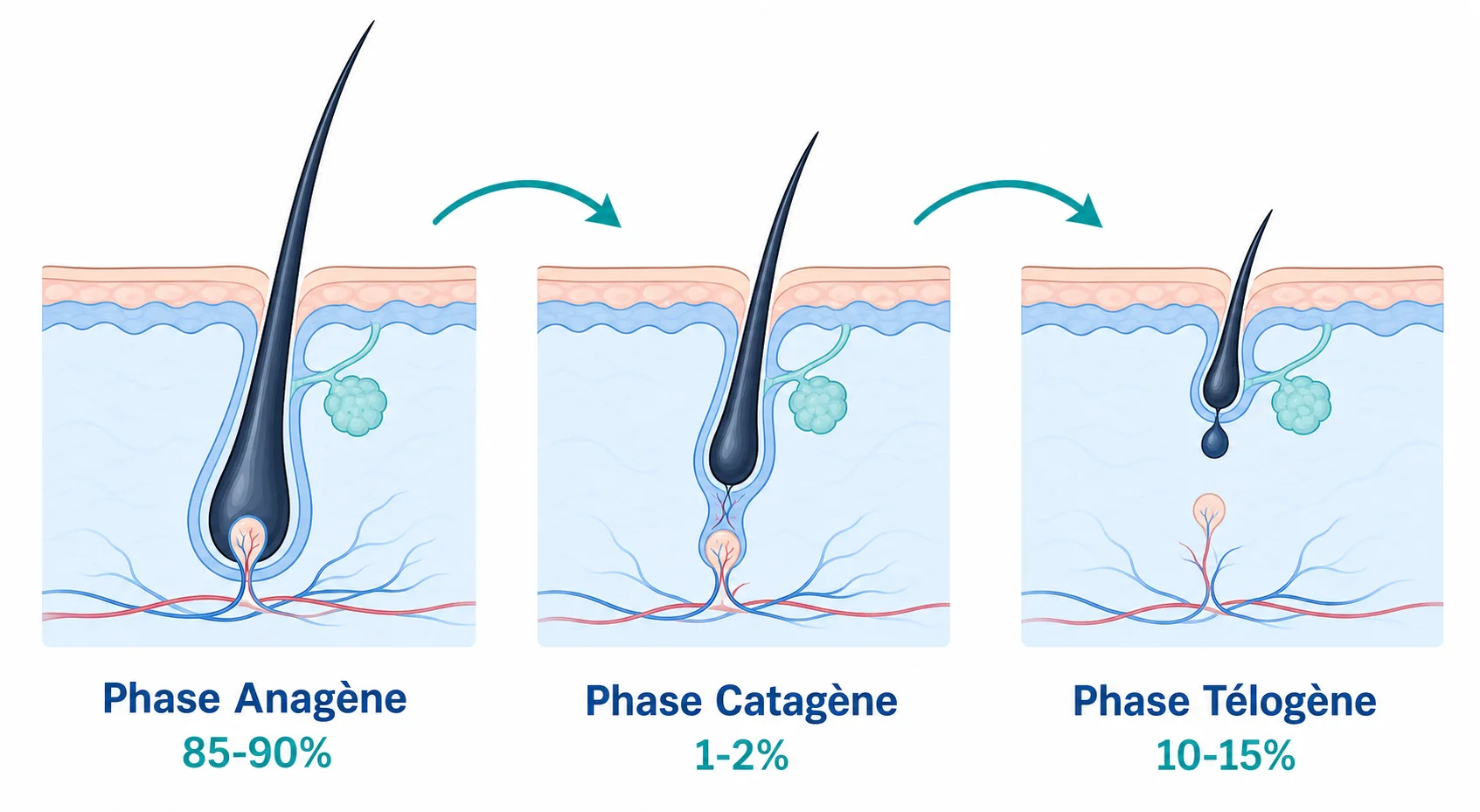 Schéma du cycle pilaire en trois phases illustrant le mécanisme de l'effluvium télogène